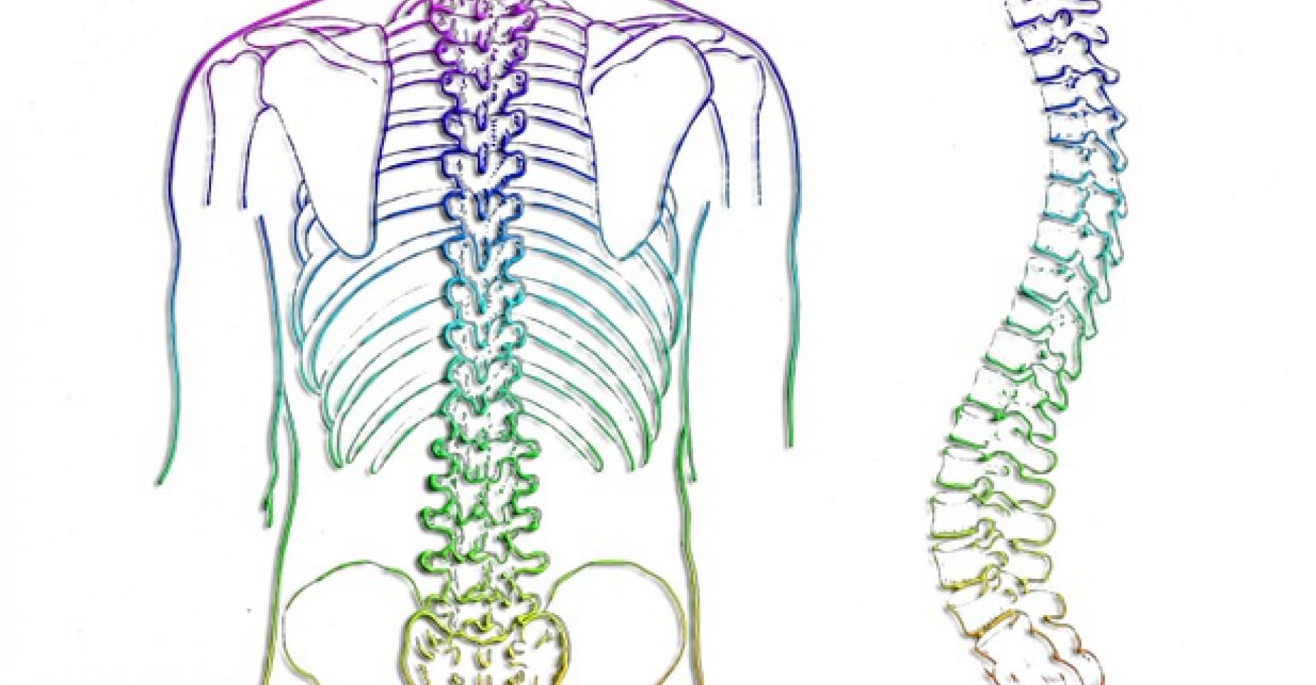 Scoliosis PNG